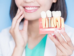 a dentist holding a model of a dental implant