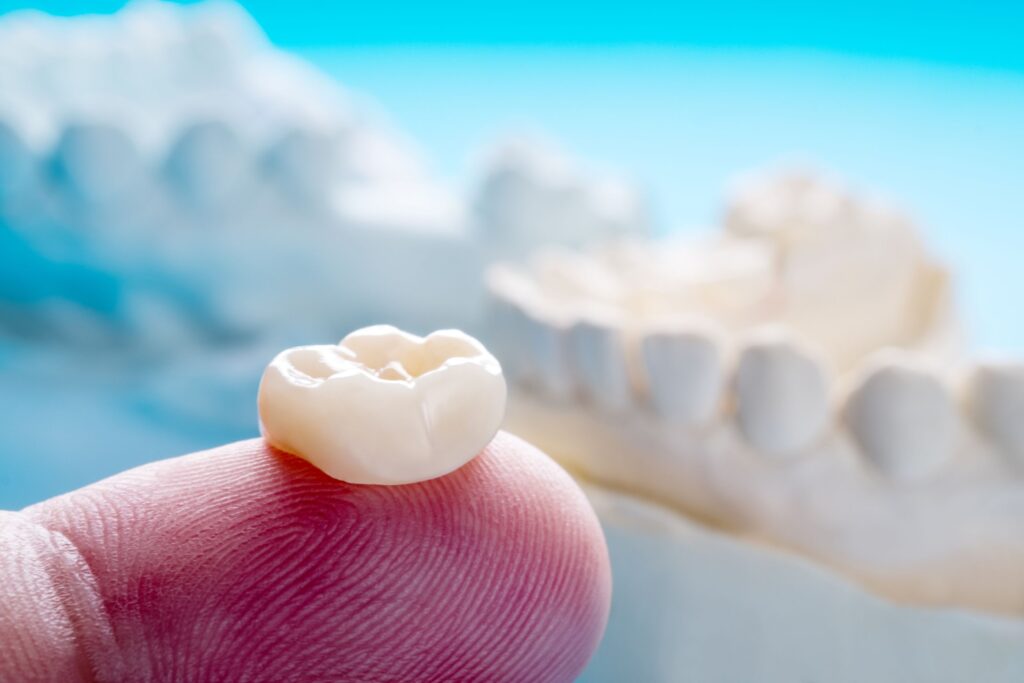 Closeup of a tooth-colored dental crown on a fingertip