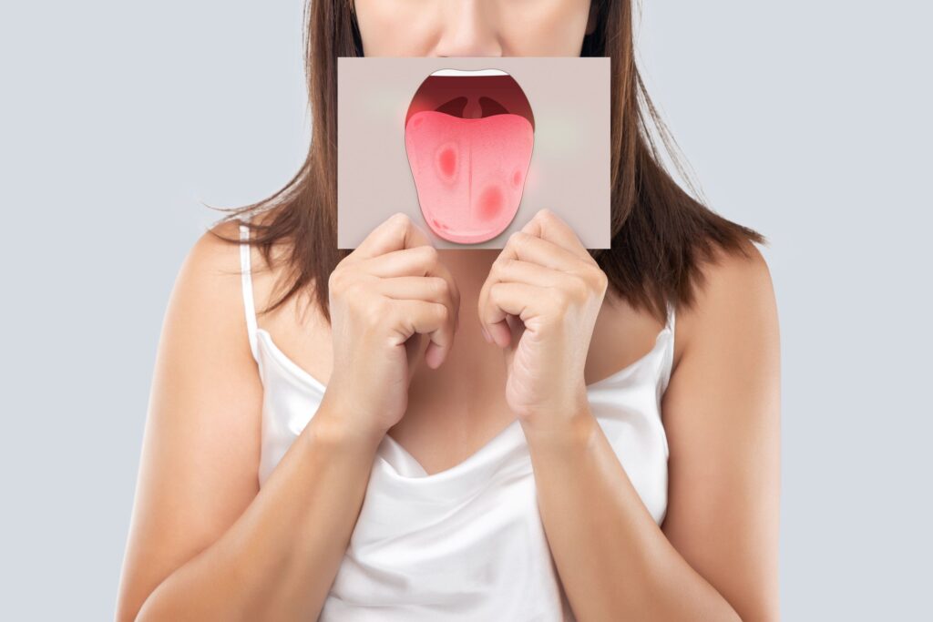 Nose down closeup of woman holding a picture of oral cancer in front of her mouth